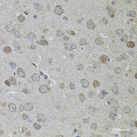 Immunohistochemistry of paraffin-embedded Mouse brain using CKAP4 Polyclonal Antibody