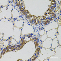 Immunohistochemistry of paraffin-embedded Mouse lung using CKAP4 Polyclonal Antibody