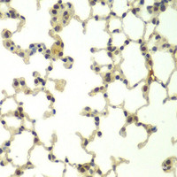 Immunohistochemistry of paraffin-embedded Mouse lung using FBXW11 Polyclonal Antibody at dilution of 1:100 (40x lens) .