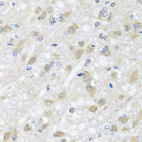 Immunohistochemistry of paraffin-embedded Rat brain using HARS2 Polyclonal Antibody at dilution of 1:100 (40x lens) .