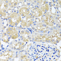 Immunohistochemistry of paraffin-embedded Mouse kidney using HARS2 Polyclonal Antibody at dilution of 1:100 (40x lens) .
