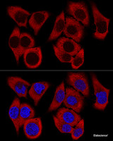 Confocal immunofluorescence analysis of HeLa cells using RPL36 Polyclonal Antibody at dilution of 1:200. Blue: DAPI for nuclear staining.