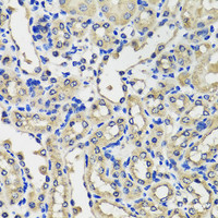 Immunohistochemistry of paraffin-embedded Mouse kidney using SCG3 Polyclonal Antibody at dilution of 1:100 (40x lens) .