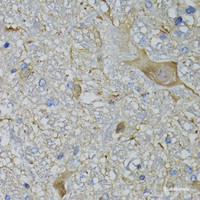 Immunohistochemistry of paraffin-embedded Mouse brain using CALML5 Polyclonal Antibody at dilution of 1:100 (40x lens) .