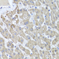Immunohistochemistry of paraffin-embedded Human liver damage using ALKBH4 Polyclonal Antibody at dilution of 1:100 (40x lens) .