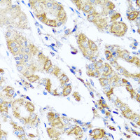 Immunohistochemistry of paraffin-embedded Human stomach using DARS2 Polyclonal Antibody at dilution of 1:100 (40x lens) .