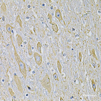 Immunohistochemistry of paraffin-embedded Mouse brain using RAB17 Polyclonal Antibody at dilution of 1:100 (40x lens) .