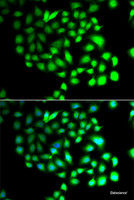 Immunofluorescence analysis of A549 cells using TCEAL8 Polyclonal Antibody