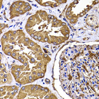 Immunohistochemistry of paraffin-embedded Human kidney using TGS1 Polyclonal Antibody at dilution of 1:100 (40x lens) .