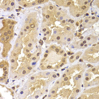 Immunohistochemistry of paraffin-embedded Human kidney using PHF21B Polyclonal Antibody at dilution of 1:100 (40x lens) .