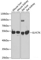 Western blot analysis of extracts of various cell lines using GLYCTK Polyclonal Antibody at dilution of 1:1000.