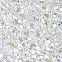 Immunohistochemistry of paraffin-embedded Rat brain using VPS37A Polyclonal Antibody at dilution of 1:100 (40x lens) .