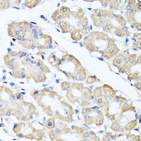 Immunohistochemistry of paraffin-embedded Human stomach using SPICE1 Polyclonal Antibody at dilution of 1:100 (40x lens) .