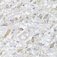 Immunohistochemistry of paraffin-embedded Rat brain using SPICE1 Polyclonal Antibody at dilution of 1:100 (40x lens) .