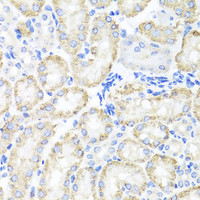 Immunohistochemistry of paraffin-embedded Mouse kidney using SPICE1 Polyclonal Antibody at dilution of 1:100 (40x lens) .