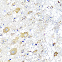 Immunohistochemistry of paraffin-embedded Rat brain using CALHM1 Polyclonal Antibody at dilution of 1:100 (40x lens) .