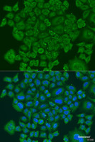 Immunofluorescence analysis of U2OS cells using NDUFS7 Polyclonal Antibody at dilution of 1:100. Blue: DAPI for nuclear staining.