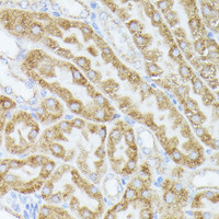 Immunohistochemistry of paraffin-embedded Mouse kidney using ACAT2 Polyclonal Antibody at dilution of 1:100 (40x lens) .