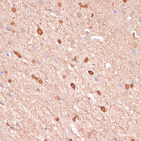 Immunohistochemistry of paraffin-embedded Rat brain using ACAT2 Polyclonal Antibody at dilution of 1:100 (40x lens) .