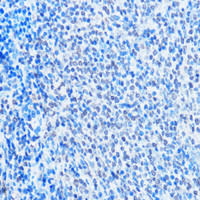 Immunohistochemistry of paraffin-embedded Rat spleen using ADAR Polyclonal Antibody at dilution of 1:100 (40x lens) .