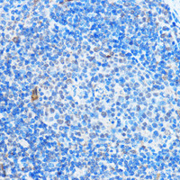 Immunohistochemistry of paraffin-embedded Mouse spleen using ADAR Polyclonal Antibody at dilution of 1:100 (40x lens) .