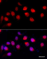 Immunofluorescence analysis of HeLa cells using ADAR Polyclonal Antibody at dilution of 1:100 (40x lens) . Blue: DAPI for nuclear staining.