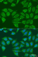 Immunofluorescence analysis of U2OS cells using ADH7 Polyclonal Antibody at dilution of 1:100. Blue: DAPI for nuclear staining.