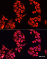 Immunofluorescence analysis of HeLa cells using ALDH9A1 Polyclonal Antibody at dilution of 1:100. Blue: DAPI for nuclear staining.