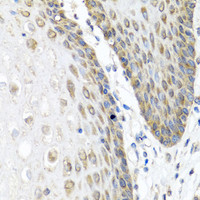 Immunohistochemistry of paraffin-embedded Human esophagus using ANGPT1 Polyclonal Antibody at dilution of 1:100 (40x lens) .