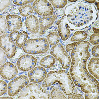 Immunohistochemistry of paraffin-embedded Rat kidney using CDH16 Polyclonal Antibody at dilution of 1:100 (40x lens) .