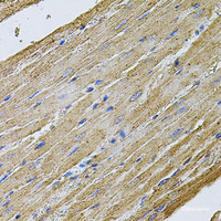 Immunohistochemistry of paraffin-embedded Rat heart using CDH16 Polyclonal Antibody at dilution of 1:100 (40x lens) .