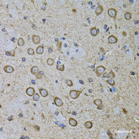 Immunohistochemistry of paraffin-embedded Mouse brain using CDH16 Polyclonal Antibody at dilution of 1:100 (40x lens) .