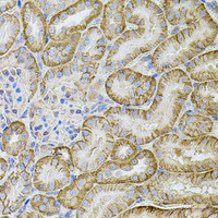 Immunohistochemistry of paraffin-embedded Mouse kidney using CDH16 Polyclonal Antibody at dilution of 1:100 (40x lens) .