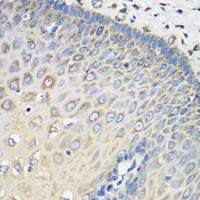 Immunohistochemistry of paraffin-embedded Human esophagus using EEF1G Polyclonal Antibody at dilution of 1:100 (40x lens) .