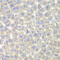Immunohistochemistry of paraffin-embedded Mouse liver using EYA3 Polyclonal Antibody at dilution of 1:100 (40x lens) .