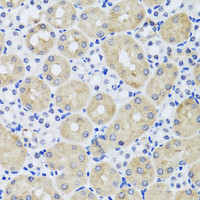 Immunohistochemistry of paraffin-embedded Mouse kidney using FGF13 Polyclonal Antibody at dilution of 1:100 (40x lens) .