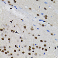 Immunohistochemistry of paraffin-embedded Rat brain using GTF2I Polyclonal Antibody