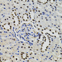 Immunohistochemistry of paraffin-embedded Rat kidney using GTF2I Polyclonal Antibody