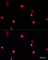 Immunofluorescence analysis of A431 cells using GTF2I Polyclonal Antibody at dilution of 1:100. Blue: DAPI for nuclear staining.