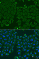 Immunofluorescence analysis of U2OS cells using IFNA6 Polyclonal Antibody at dilution of 1:100. Blue: DAPI for nuclear staining.