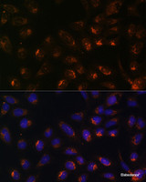 Immunofluorescence analysis of U-2 OS cells using ITPR1 Polyclonal Antibody at dilution of 1:100. Blue: DAPI for nuclear staining.