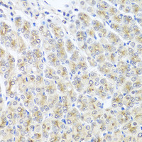 Immunohistochemistry of paraffin-embedded Mouse stomach using MTX1 Polyclonal Antibody at dilution of 1:100 (40x lens) .