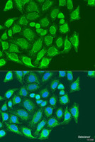 Immunofluorescence analysis of U2OS cells using MTX1 Polyclonal Antibody at dilution of 1:100. Blue: DAPI for nuclear staining.