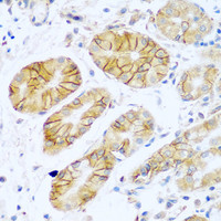 Immunohistochemistry of paraffin-embedded Human stomach using NCAM1 / CD56 Polyclonal Antibody at dilution of 1:100 (40x lens) .