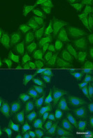 Immunofluorescence analysis of U2OS cells using PLOD1 Polyclonal Antibody at dilution of 1:100. Blue: DAPI for nuclear staining.