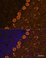 Immunofluorescence analysis of Rat brain cells using PRKCG Polyclonal Antibody at dilution of 1:100. Blue: DAPI for nuclear staining.