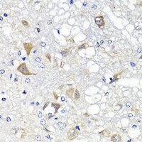 Immunohistochemistry of paraffin-embedded Rat brain using PSPH Polyclonal Antibody at dilution of 1:100 (40x lens) .
