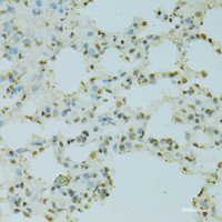 Immunohistochemistry of paraffin-embedded Rat lung using SAFB Polyclonal Antibody at dilution of 1:100 (40x lens) .