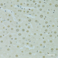 Immunohistochemistry of paraffin-embedded Rat liver using SAFB Polyclonal Antibody at dilution of 1:100 (40x lens) .