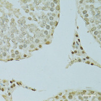 Immunohistochemistry of paraffin-embedded Rat testis using SAFB Polyclonal Antibody at dilution of 1:100 (40x lens) .